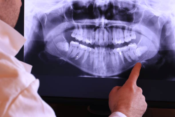 Best Broken Tooth Emergency  in Melville, NY