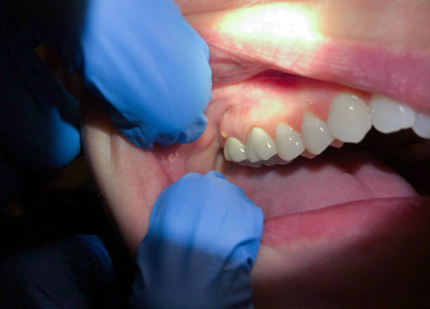 Best Cracked Tooth Emergency Dentist  in Melville, NY